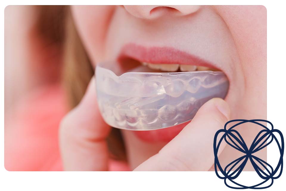 Custom Mouth Guards at Enspire Dental. Ann Arbor, Michigan, USA